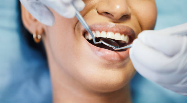 Best Emergency Cosmetic Dentistry in Walnut Creek, OH